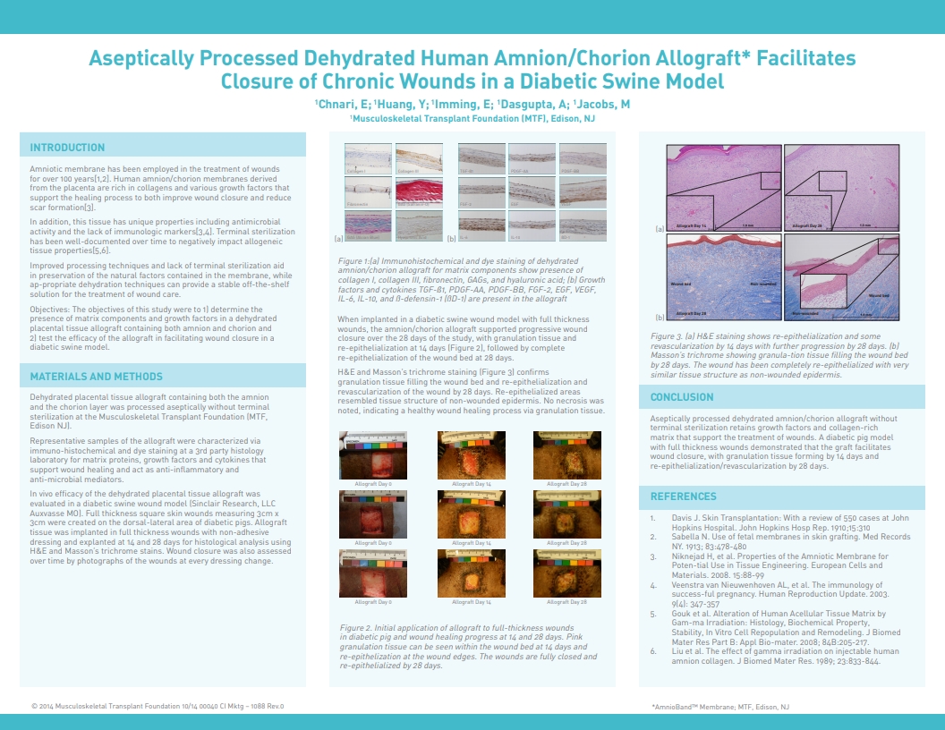 Chnari E, Dasgupta A, Huang YC, Jacobs M. Aseptically Processed Dehydrated Human Amnion/Chorion Allograft Promotes Healing of Chronic Wounds in a Diabetic Swine Model. SAWC 2014 Fall. Las Vegas, NV, USA